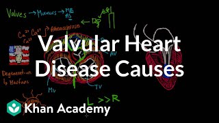 Valvular heart disease causes  Circulatory System and Disease  NCLEXRN  Khan Academy [upl. by Oap974]