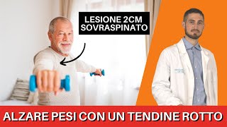 Come si può ALZARE PESI con una LESIONE di un tendine della spalla [upl. by Tabb]