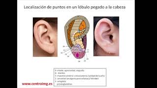 53 Puntos de auriculoterapia en lóbulo unido a la cabeza Centro IMG [upl. by Quirk727]