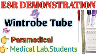 ESR Explained Wintrobe Tube Demonstration  Understanding Blood Sedimentation [upl. by Allac]