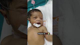 Baby didnt cry after birth nicu serious birth asphyxia [upl. by Attegroeg]