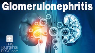 Renal Emergencies Glomerulonephritis [upl. by Wyatan]