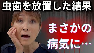 １本の虫歯で体のバランスが崩れるってホント！？ [upl. by Gore]