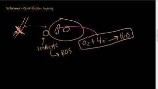 12  Examples of cell injuries  Ischemia Hypoxia IschemiaReperfusion Injury [upl. by Jocko]