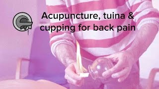 Acupuncture tuina Chinese massage and cupping for back pain [upl. by Ecitnerp]