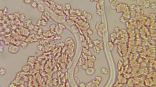 Heartworm in dogs CIAB wwwciabes [upl. by Mannie]