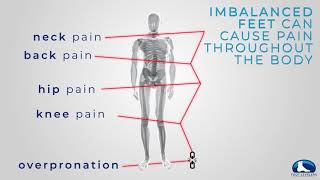 Overpronation and the footspine connection [upl. by Rochell]