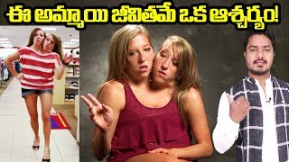 Story of Strange Girls  Conjoined Twins  Abigail amp Brittany Hensel  VikramAditya  EP168 [upl. by Kaycee]