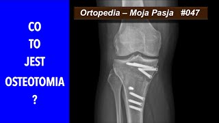 Co to jest OSTEOTOMIA  OMP047 [upl. by Aonian]