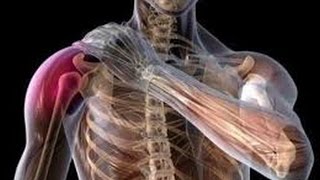 An Effective Self Treatment for ShoulderTendonitis How To Sleep Better with Shoulder Pain [upl. by Odetta698]