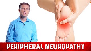 How to Relieve Peripheral Neuropathy Pain – Dr Berg [upl. by Crowell]