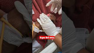 cannula kaise lagate h nursingofficer medicalprocedure mbbs cannula [upl. by Anahsar]