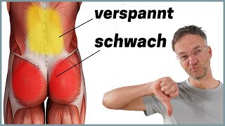 Die häufigste Ursache für Rückenschmerzen Anatomie erklärt [upl. by Sublett541]