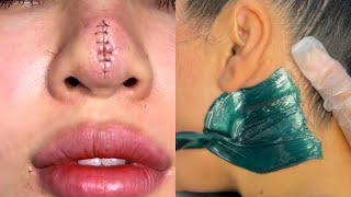 Most Extreme Beauty Treatments 2023 Best Smart and Helpful Beauty Hacks  Virtual Beauty [upl. by Lorin57]