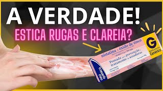 NÃO USE MUITO A Verdade Sobre A Pomada Nistatina  Oxido De Zinco CUIDADO [upl. by Lonnard583]