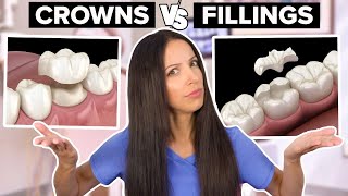 Dental Crowns Vs Dental Fillings Whats the Difference [upl. by Jaeger]