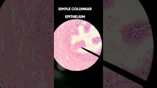 Epithelial tissue histology slides Pathology part 1 [upl. by Bradway]