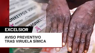 Viruela símica Secretaría de Salud emite aviso preventivo de viaje [upl. by Seuqirdor]