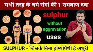 Sulphur is a homeopathic medicine for all skin problems How to use it without aggravationsulphur [upl. by Yasibit]