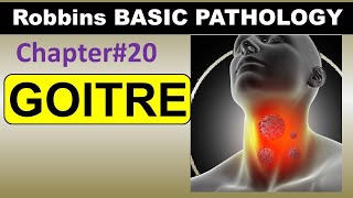 Ch20  GOITRE Pathology  Robbins Pathology  Dr Asif Lectures [upl. by Currey]