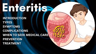 What is Enteritis  Enteritis Prevention and Treatment [upl. by Lesslie234]