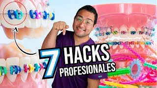 7 TIPS  HACKS  TRUCOS PROFESIONALES para los que tienen BRACKETS  ORTODONCIA [upl. by Eaves429]