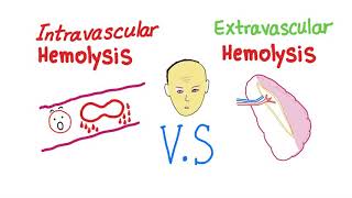 Intravascular Vs Extravascular Hemolytic Anemia Whats The ACTUAL Difference [upl. by Barrington]