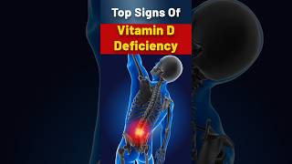 Vitamin D Deficiency Key Symptoms And Why This Vital FatSoluble Vitamin is Crucial for Your Health [upl. by Liddie]