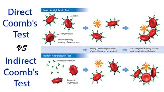 DCT amp ICT pathology pathologylab hematology hemepath immunology [upl. by Kahle330]