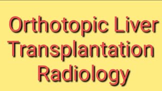 Orthotopic Liver Transplantation Radiology [upl. by Wedurn]