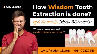 How to remove wisdom tooth  Is it painless A step by step guide by FMS Dental [upl. by Aracat426]