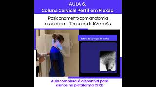 Cervical Perfil em Flexão tecnciasradiologicas radiologia [upl. by Siocnarf36]