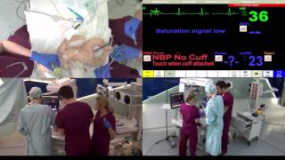 Simulation Training A Neonatology Resuscitation Scenario [upl. by Doownil]