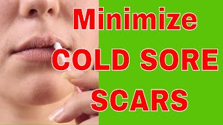 How Can I Minimize COLD SORE SCARS [upl. by Venator]