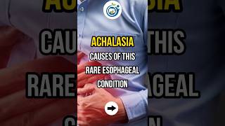 ACHALASIA CAUSES OF THIS RARE ESOPHAGEAL CONDITION shorts achalasia esophagus doctor [upl. by Wilkens404]