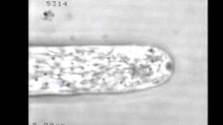 Cytoplasmic contractions in growing fungal hyphae and their morphogenetic consequences [upl. by Sankey]