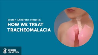 How we treat tracheomalacia  Boston Childrens Hospital [upl. by Eliga]