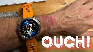 HELP My New Garmin Fenix 8 Is Beating Me Up [upl. by Yreffeg]