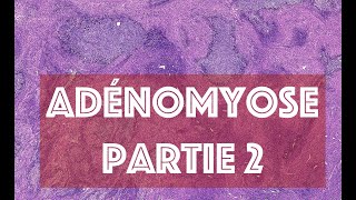 LADENOMYOSE partie 2  PATHOLOGIE [upl. by Em]