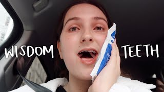 GETTING MY WISDOM TEETH REMOVED  vlog  storytime [upl. by Amaj]