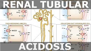 Renal Tubular Acidosis [upl. by Einnoj]