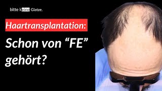 Basiswissen Haartransplantation  Folge 4 [upl. by Ddart]