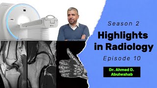 Highlights in Radiology S2 E10 Osteosarcoma [upl. by Mezoff]