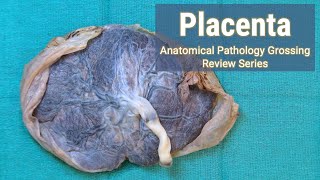 Placenta  Anatomical Pathology Grossing Review Series [upl. by Marney]