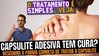 Capsulite adesiva O que causa e como tratar da forma correta Como recuperar o movimento do ombro [upl. by Eliak492]