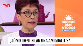 Doctora Herrera responde ¿Cómo identificar una amigdalitis  Buenos días a todos [upl. by Vergil]