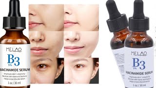 Melao B3 5 Niacinamide Serum Review in Bangla একটি সিরাম ব্যাবহার করে মুখের সব কালো দাগ দূর করুণ [upl. by Aharon]