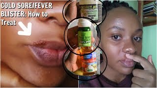 How I Treated This COLD SORE FEVER BLISTER NATURALLY OVERNIGHT plus my cold sore stages [upl. by Abie37]