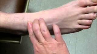 Sample Video  Palpate for Dorsalis Pedis Pulse [upl. by Chi]