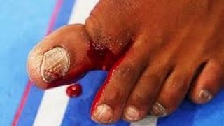 JON quotBONESquot JONES BROKEN TOE THE quotSNAPquot IN SLOW MOTION UFC 159 [upl. by Grunberg398]